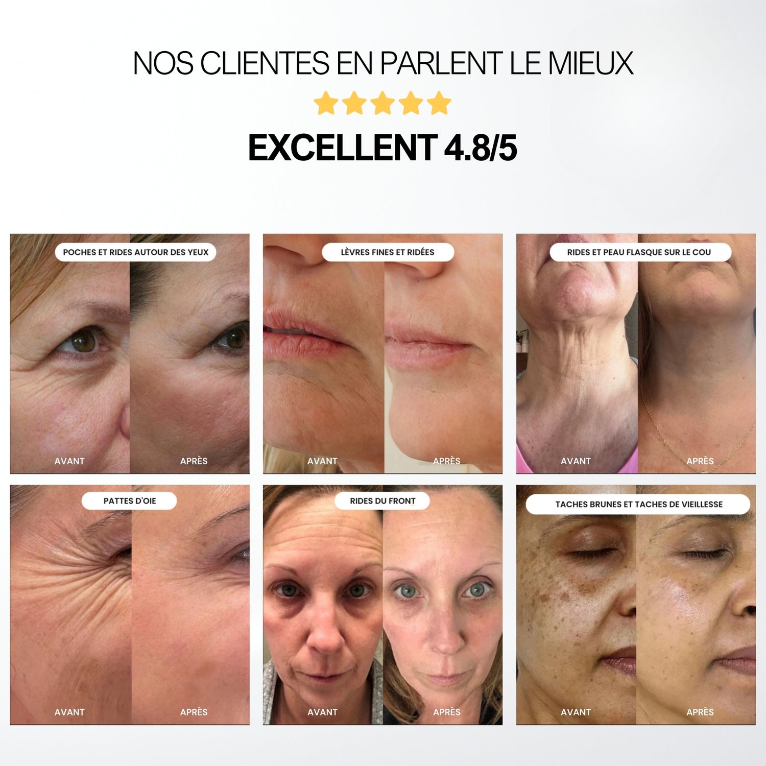 KIT MICRO-INFUSION - Anti-Âge & Réduction des Rides et Ridules